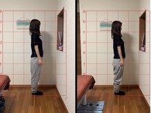 アロハ(ALOHA)/マタニティ/マタニティ整体