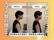 ルルラボ(LuLu beauty labo)/スマホ首を直すと見た目が変わる