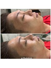 リラクゼーションサロン ポーム(Paume)/シェービング