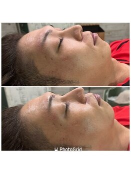 リラクゼーションサロン ポーム(Paume)/シェービング