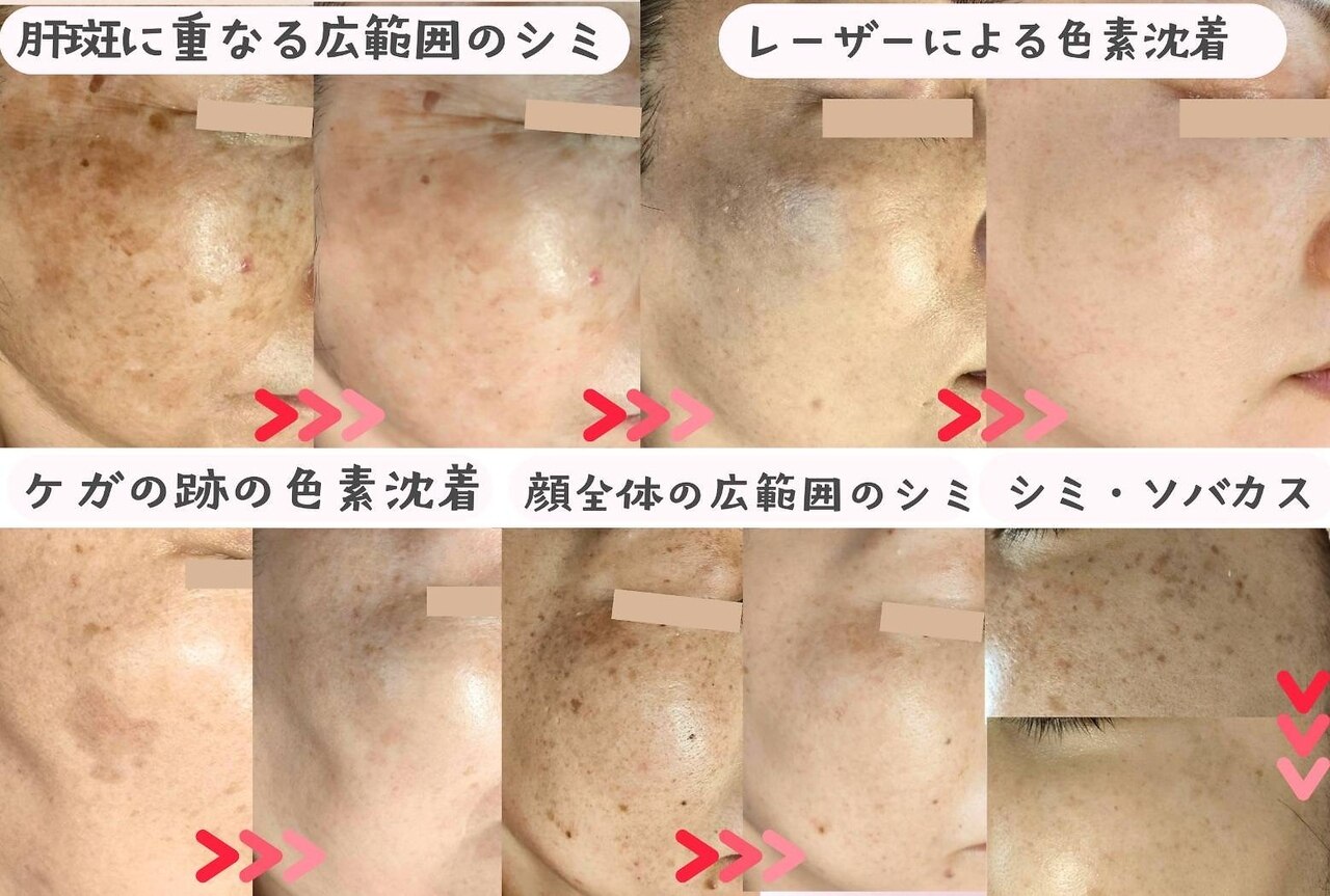モモイロ(momoiro)｜ホットペッパービューティー