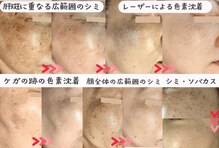 モモイロ(momoiro)