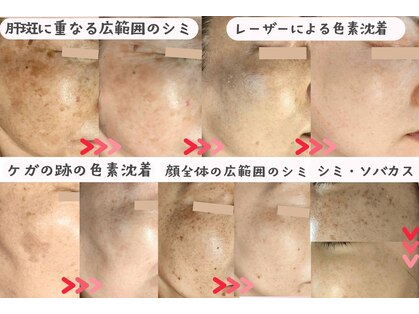 モモイロ(momoiro)の写真