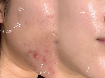 モア(more.)の写真