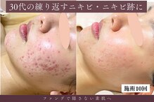 アロマ(AROMA)