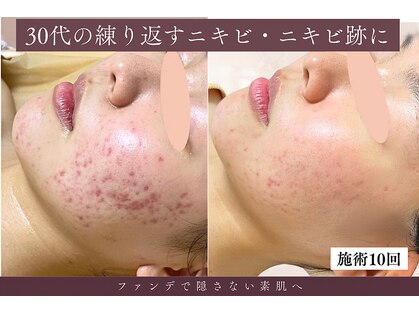 アロマ(AROMA)の写真