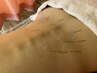 【6月限定10分拡大】腰痛改善プラン 整体+鍼灸セット80分 10,870円→8,670円