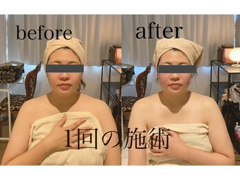 ラ フルール 折尾店/小顔矯正コルギ&頭蓋骨矯正