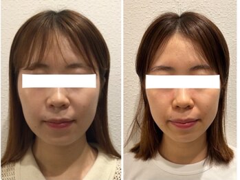 美容整体 ウェリナ 蟹江院/小顔矯正/骨盤矯正/美脚サロン