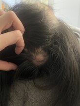 トラ 恵比寿店(TORA)/円形にも効果あり