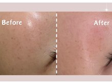 シー センター北(sii)/フォト美顔