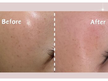 シー センター北(sii)/フォト美顔