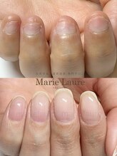 マリーロール 淀屋橋本店(Marie Laure)/自爪育成/深爪矯正/ネイルケア