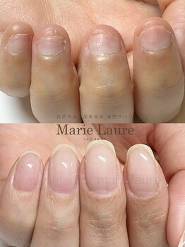マリーロール 淀屋橋本店(Marie Laure)/自爪育成/深爪矯正/ネイルケア