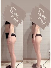 ギャラクシービューティー(galaxy beauty)/ハイパーナイフ