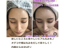 アルページュ(Arpege)/バブ丸み＆ヒアル効果♪水滴LDM