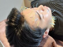 鍼灸院ネクストステップ(鍼灸院NextStep)