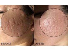 ビーマジック(美magic)/サーマトリックス