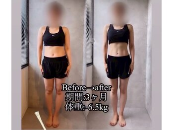 インプルーブ エステティック(Improve ESTHETIC)/