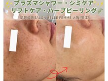 ベルファーム(Belle Femme)