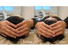 エネ ラッシュアンドブロウ バイ アンドエラ(ENNE Lash&Blow by&ERA)/美脳トレーニングスパ