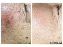 エステサロン JJシャンハイの雰囲気（光フェイシャルでシミケアくすみケア！お肌の透明感もアップ！）