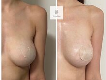 ソナ 大和西大寺院(SONA)/