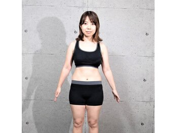 ベイシス 札幌店(BASIS)/お客様事例 S様 20代女性 2ヶ月