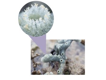 ティアラ(TIARA)/幹細胞エクソソーム針を使わない