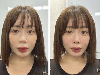 たんぽ美容整体 池袋店/小顔矯正