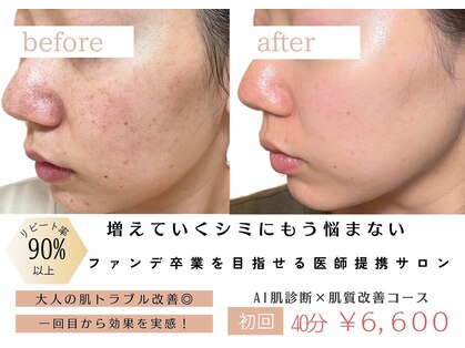 パリス(PALIS)の写真