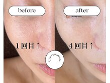 ユヌランコント 岐阜店(Une rencontre)/ララピール