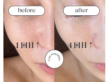 ユヌランコント 岐阜店(Une rencontre)/ララピール