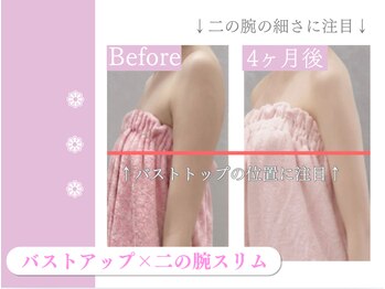 キアナ 横浜店(Kiana)/ダイエット×バストアップ結果