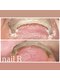 ネイルアール(nail R)の写真/美爪へ導くプロ！角質除去はお任せ下さい◎巻き爪矯正で足のお悩みも解決♪