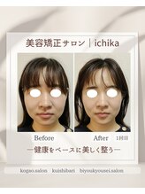 イチカ 仙川店( ichika)/お顔のこわばりを緩める