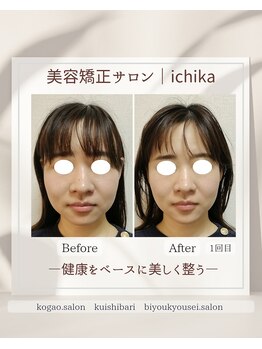 イチカ 仙川店( ichika)/お顔のこわばりを緩める