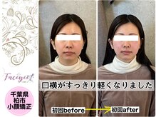 フェイシー(faceyee)/