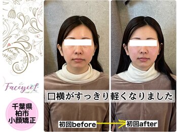 フェイシー(faceyee)/