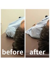 熊本カワル整体 JR上熊本駅院/巻き肩