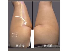 アリアグロウ(Aria Glow.)/ヒップアップ