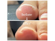 ヘルモッソ(hermoso)の雰囲気（～巻き爪ケアの出来るサロン～）