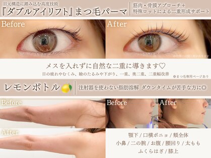 ミーカラー(mecalla.)の写真