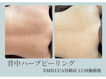 エミルカ 宮崎店(EMILUCA)の写真