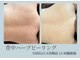 エミルカ 宮崎店(EMILUCA)の写真