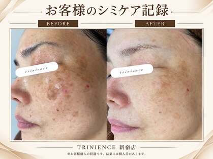 トリニエンス 新宿店(TRINIENCE)の写真