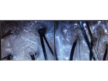 シルフ エルスパ 阪急茨木店(Sylph &EirSPA)/