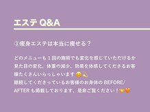 ルアバイアロ(Lua by Alo's)/