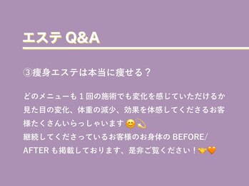 ルアバイアロ(Lua by Alo's)/