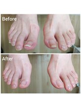 リゼラアンドコー 宇都宮陽南店/ドイツ式フットケア専門店